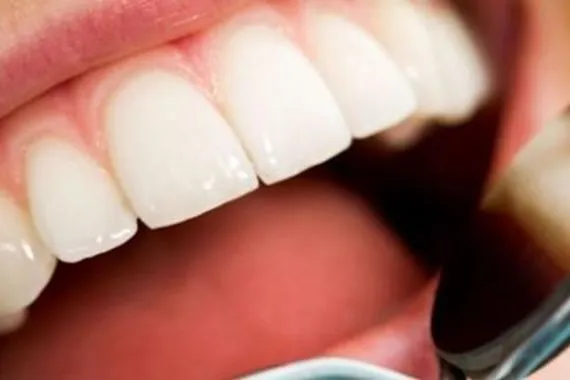 نصائح علمية لحماية الاسنان من التسوس