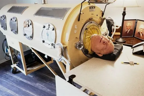 عاش 70 عاما "برئة حديدية".. وفاة الأمريكي بول ألكسندر