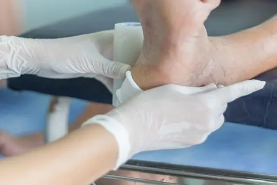 ابتكار جوارب إلكترونية تنهي تقرحات القدم لدى مرضى السكري