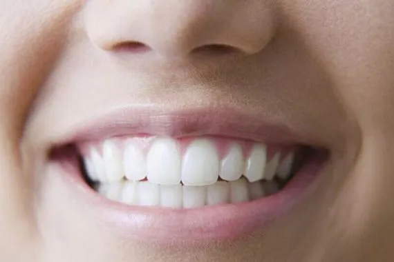 تحاليل تظهر ارتباط بين فقدان الأسنان وزيادة خطر السمنة