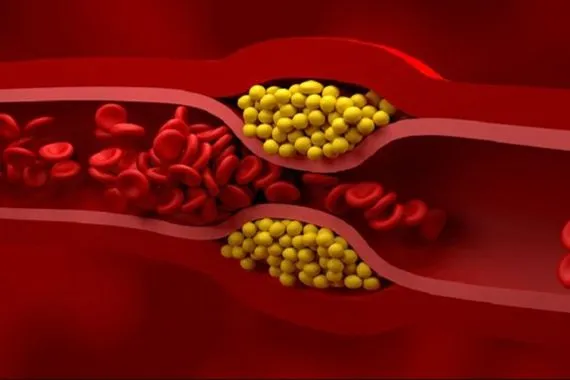 دراسة تكشف عن غذاء مثالي يساعد على تقليل الكوليسترول