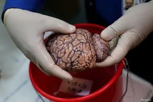 دراسة تحذر مُحلّي شائع في مشروبات الدايت يرفع خطر الإصابة بالسكتة الدماغية