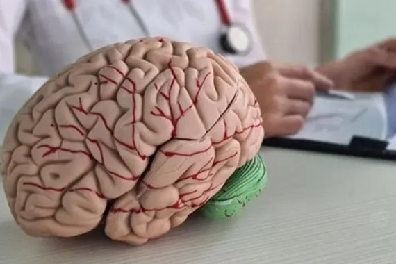 اطباء يحددون ثلاثة محاور لعلاج الرجفان المهدد بالسكتة الدماغية