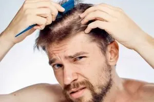 تمارسها يوميا وتظنها طبيعية عادة ستحولك إلى أصلع