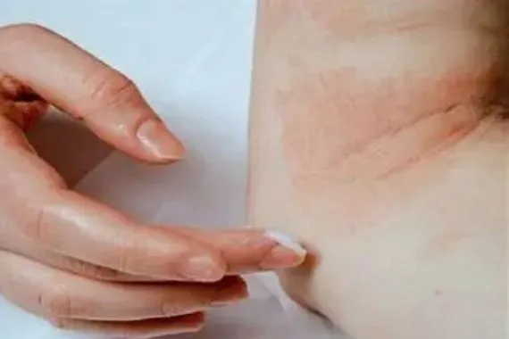 تحيط بنا طوال الوقت تعرف على أخطر مسببات الحساسية