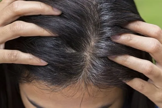 نصائح لتجنب ظهور الشيب مبكراً