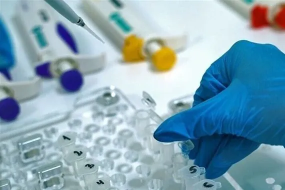 الميربيكو فيروس تنفسي جديد يقترب من الانتشار