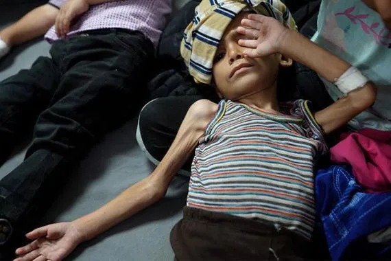 مستشفيات غزة تحذر أجسام المرضى لم تعد قادرة على التحمل قناة العالم الاخبارية