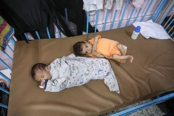 غزة تواجه خطر الموت الجماعي لـ 100 ألف طفل اثر نقص حليب