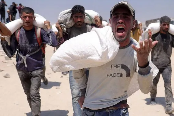 الصحة العالمية سوء التغذية بلغ مستويات تنذر بالخطر في غزة