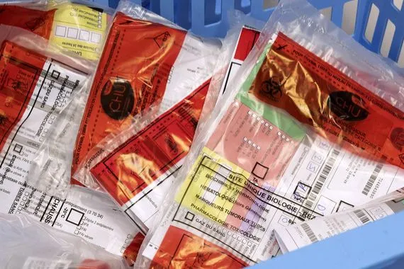 فرنسا عدوى قاتلة تفتك بشخصين وتصيب 21 آخرين وشبهات حول شركة أجبان شفق نيوز