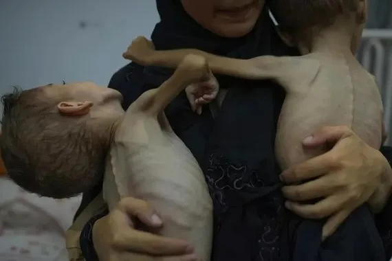 أكثر من 1 2 مليون طفل يعانون من انعدام أمن غذائي حاد