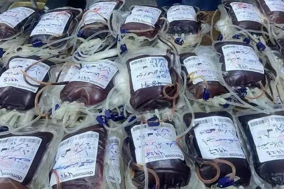العراق جدل حول سلامة أكياس الدم بعد إصابة فتى بالإيدز