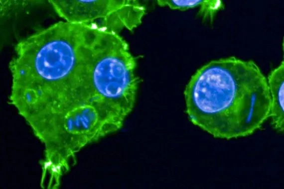 البكتيريا تقهر الطب العالم على أعتاب عصر ما بعد المضادات