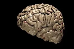 علماء يبتكرون علاجاً للزهايمر يفوق فيتامين K الطبيعي بثلاثة أضعاف