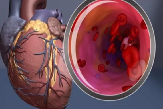 دراسة كندية تكشف خطورة الدهون الداخلية على القلب والدماغ