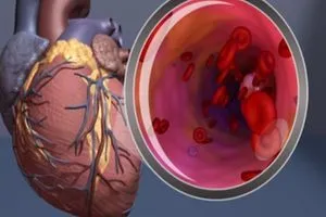 دراسة كندية تكشف خطورة الدهون الداخلية على القلب والدماغ