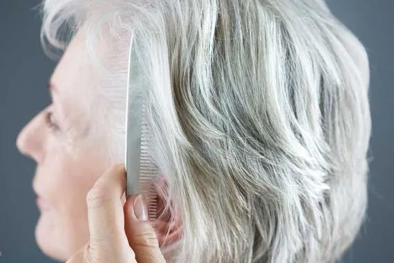 دراسة شيب الشعر قد يحمي الجسم من أخطر سرطانات الجلد وكالة الانباء العراقية واع