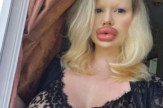 رسالة من صاحبة أكبر شفاه في العالم