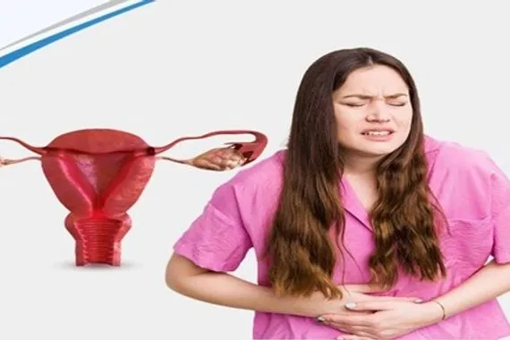 حمية غذائية للوقاية من التهابات بطانة الرحم