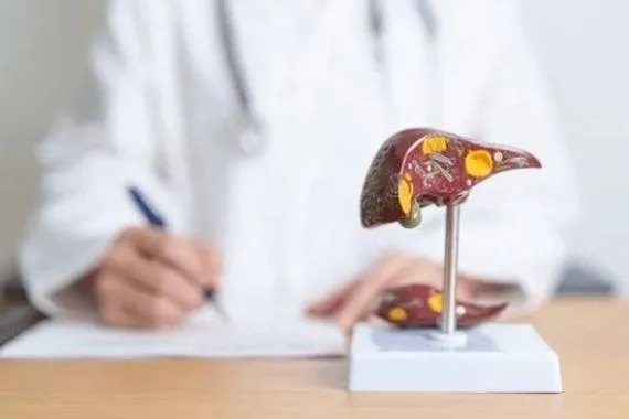 عادات صباحية بسيطة تعزز صحة الكبد وتقلل أمراضه