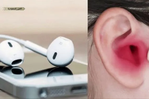 قد يهدّد سمعك احذر هذا النوع من سماعات الأذن وكالة بغداد اليوم الاخبارية