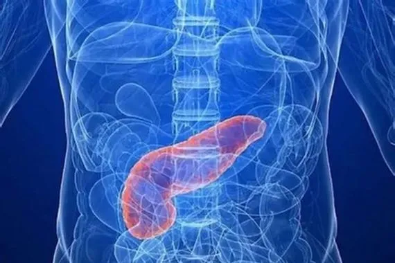 اختبار تنفس جديد يكشف سرطان البنكرياس في مراحله المبكرة