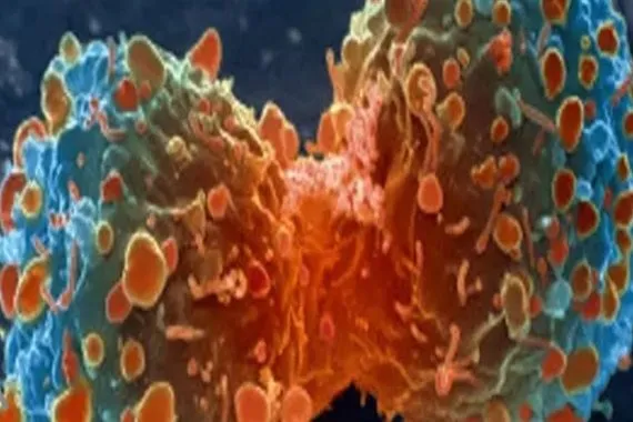 الكشف عن آلية جديدة تحفّز المناعة لعلاج سرطان البنكرياس وكالة الانباء العراقية واع