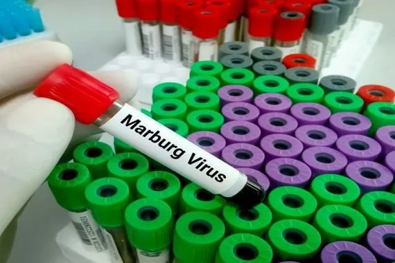 منظمة الصحة العالمية تحذر من تفشي فيروس ماربورغ القاتل