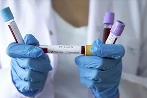 دراسة تكشف مؤشرات غير طبيعية للمصابين بـ كوفيد طويل الأمد