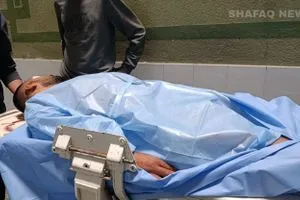 خاص ارتفاع حالات فقدان البصر بين الفلسطينيين جراء القصف الإسرائيلي صور شفق نيوز