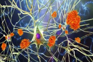 النبات المعجزة مفتاح جديد لعلاج ألزهايمر وكالة الانباء العراقية واع