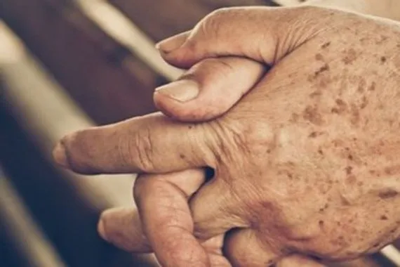 ما أسباب الحكة المزمنة لدى كبار السن