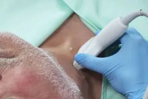 فحص طبي جديد يتنبأ بالنوبات القلبية قبل حدوثها شفق نيوز