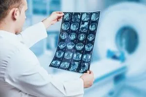 باحثون يطورون علاجاً مبتكراً لسرطان الدماغ عبر قطرات أنفية