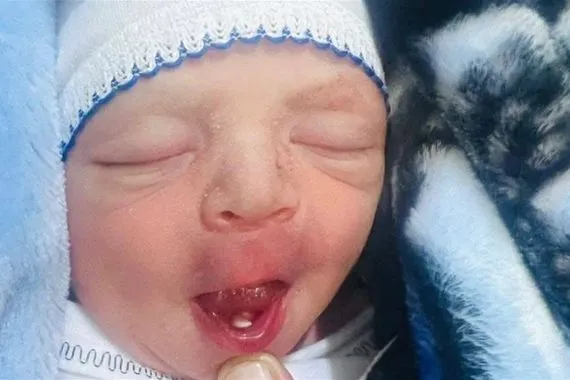 مولود جديد يُفاجئ الأطباء بسن لبني عند الولادة في بابل صورة