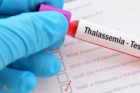 بينها تخص الزواج الصحة إجراءات للحد من الإصابة بمرض الثلاسيميا وكالة الانباء العراقية واع