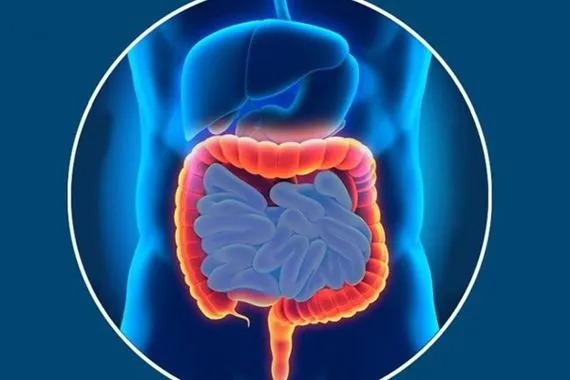 باحثون يكتشفون مؤشراً مبكراً لالتهاب الأمعاء