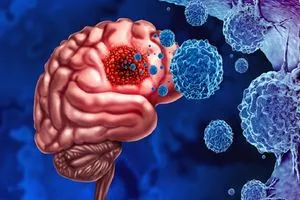 ابتكار مستشعرات نانوية لتحديد نوع سرطان الدماغ