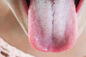 لسانك اول المحذرين الذكاء الاصطناعي يكتشف السكري وسرطان المعدة من الفم