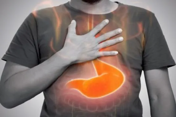 كيف يمكن التخلص من حرقة المعدة المستمرة دون أدوية